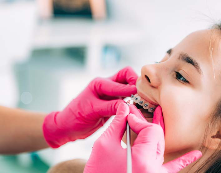 Early Orthodontics for Children