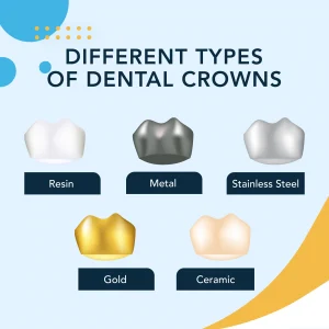 Everything You Need to Know About Dental Crowns