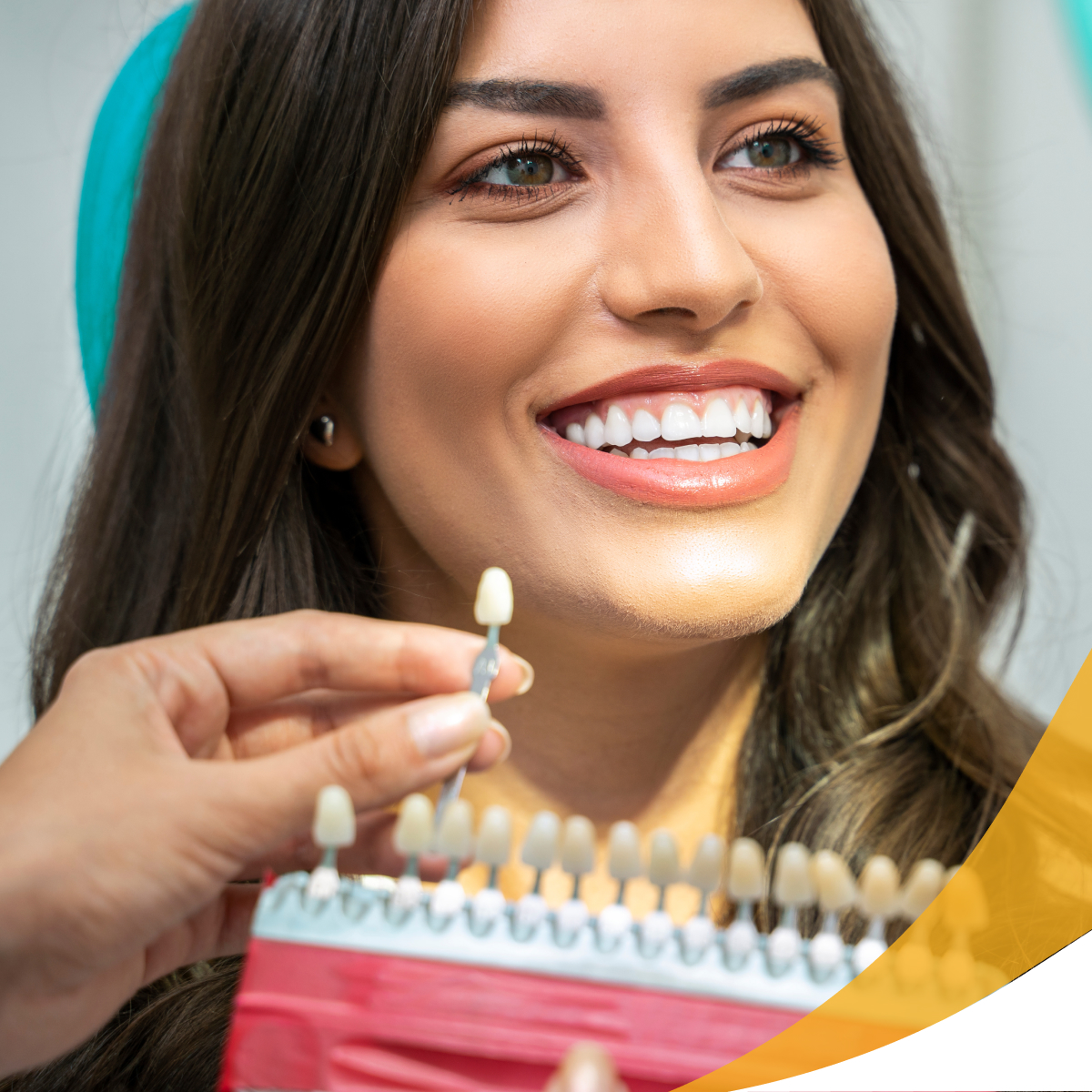 Exploring Different Teeth Whitening Options Which One is Right for You