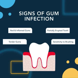 Signs That Your Wisdom Teeth Need to Be Removed