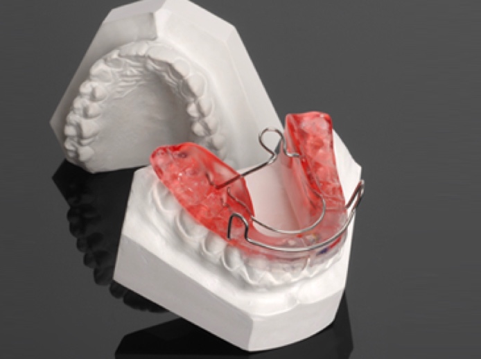 modal of braces
