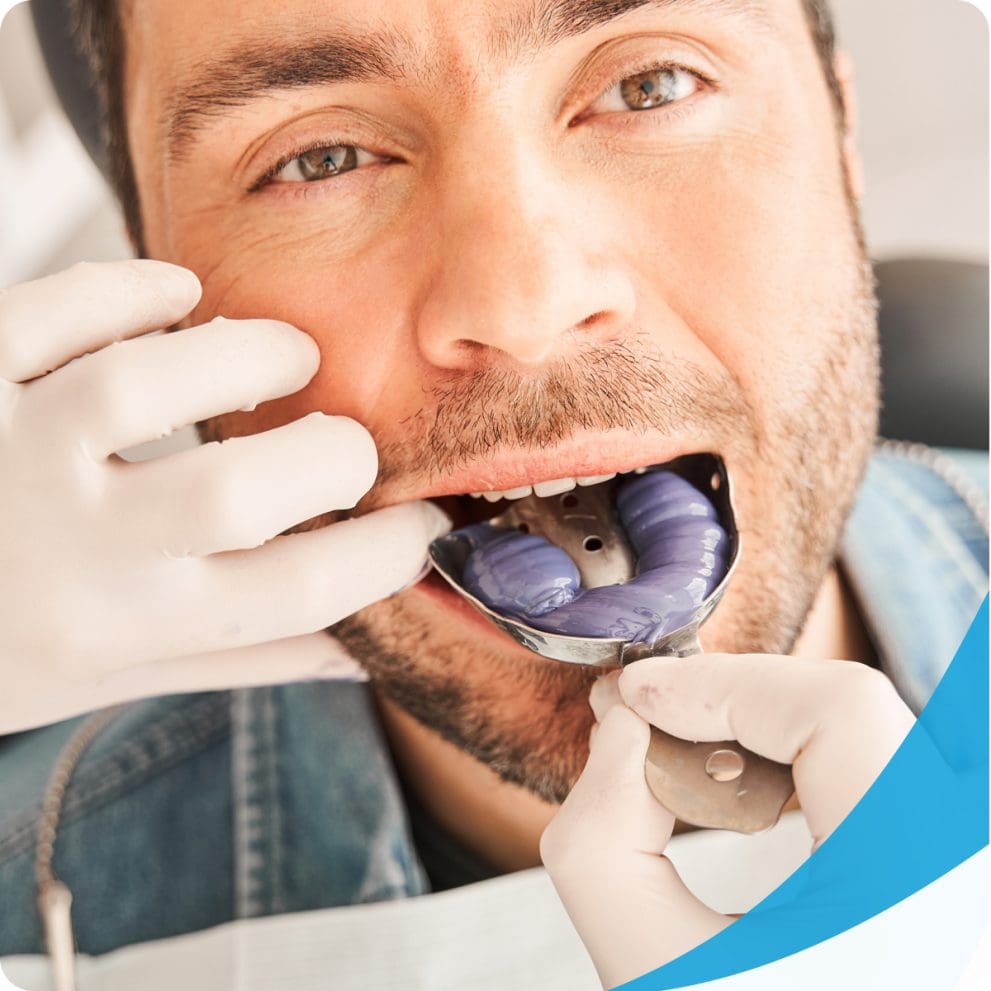 What Are Dental Impressions? Smile Every Day Dentistry