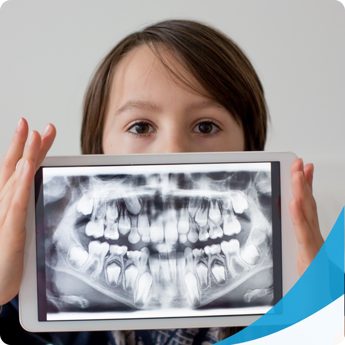 Why Do You Need Dental XRays Smile Every Day Dentistry